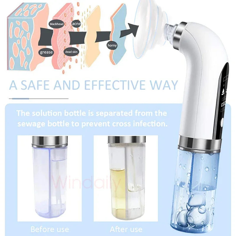 Emeka Black Head Remover Pore Vacuum Cleaner Electric Micro Small Bubble Facial Cleasing Machine USB Rechargeable Beauty Device